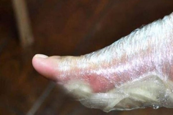Ce se intampla daca-ti pui ceapa pe talpi pe timpul noptii - un leac chinezesc de mii de ani